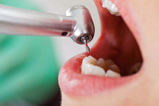 Best Dental Abscess Treatment in Man, WV
